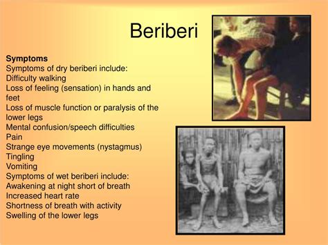 Beriberi: Video, Anatomy, Definition & Function .